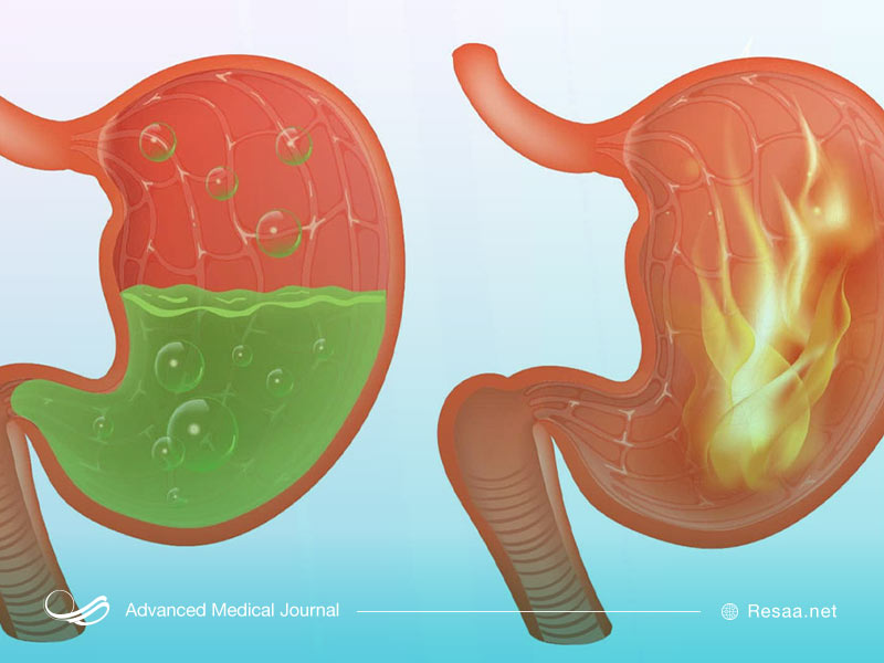 استفراغ به رنگ قهوه میتواند نشانه ورم معده باشد