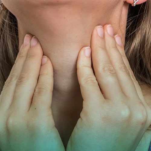 بیماری گواتر چیست؟ علائم، تشخیص و درمان گواتر