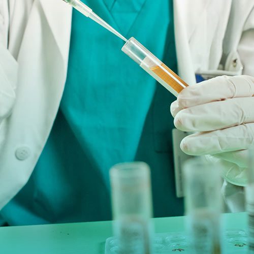 بیماری هماچوری یا وجود خون در ادرار چیست؟