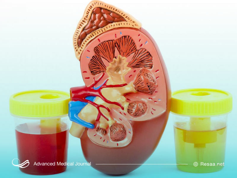 هماچوری چیست؟