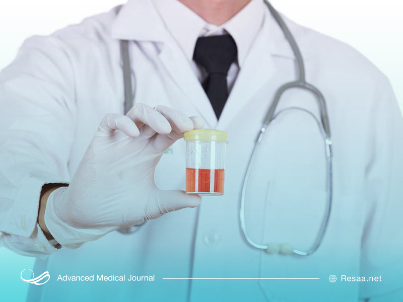 علایم هماچوری چیست؟