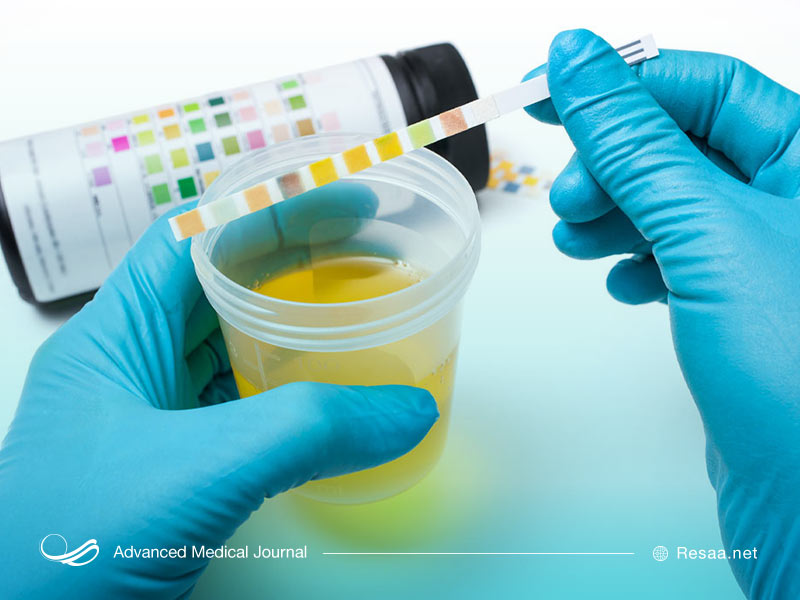 راههای درمان هماچوری