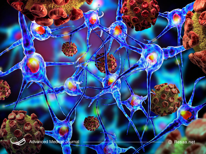 ژنها هم در این بیماری درگیر هستند
