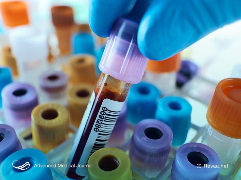 آزمایشات مورد نیاز برای تشخیص هانتینگتون