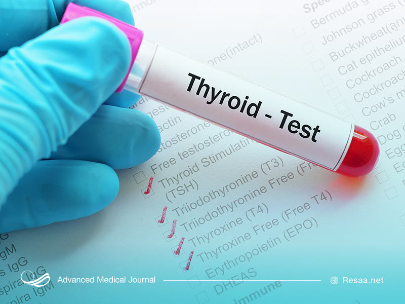 آزمایش تیروئید