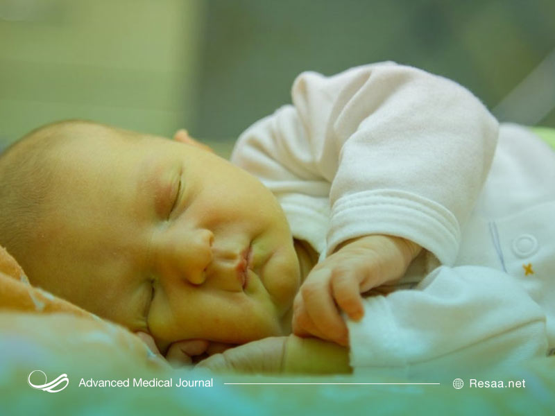 بیماری یرقان چیست؟