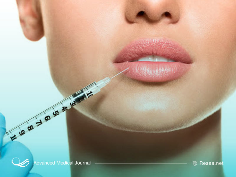 پروتز لب یا تزریق ژل؟