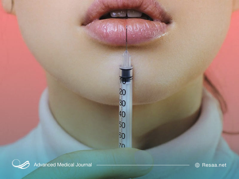 مراقبتهای بعد از پروتز لب