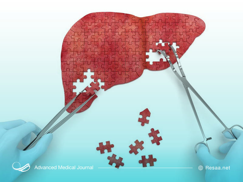 بیماری سرطان کبد در جهان رو به افزایش است