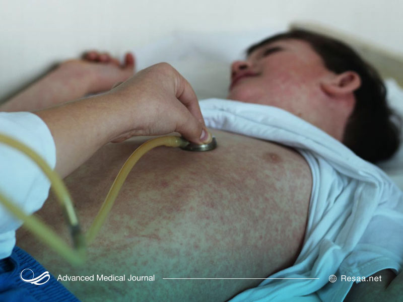 قبل از اقدام به بارداری بهتر است واکسن را دریافت کنید