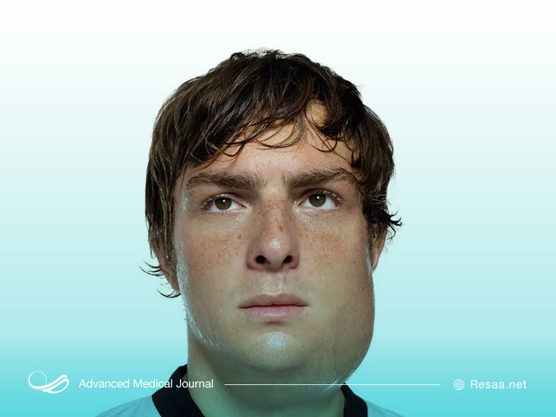 اوریون نوعی بیماری واگیردار است