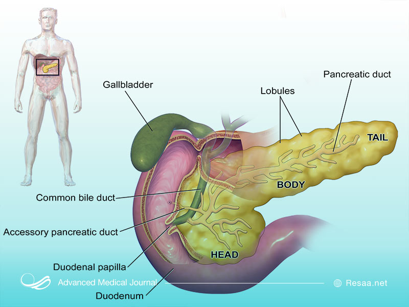 نشانه های ابتلا به پانکراتیت