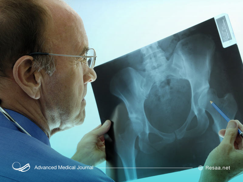 عفونت التهابی لگن قابل درمان است