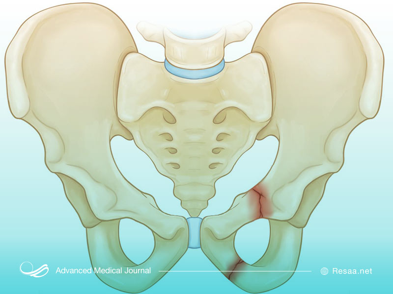 آزمایشهای تشخیصی PID