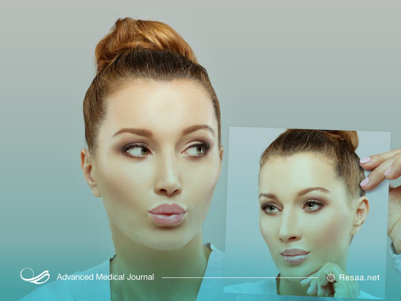 برداشتن قوز بینی با عمل جراحی