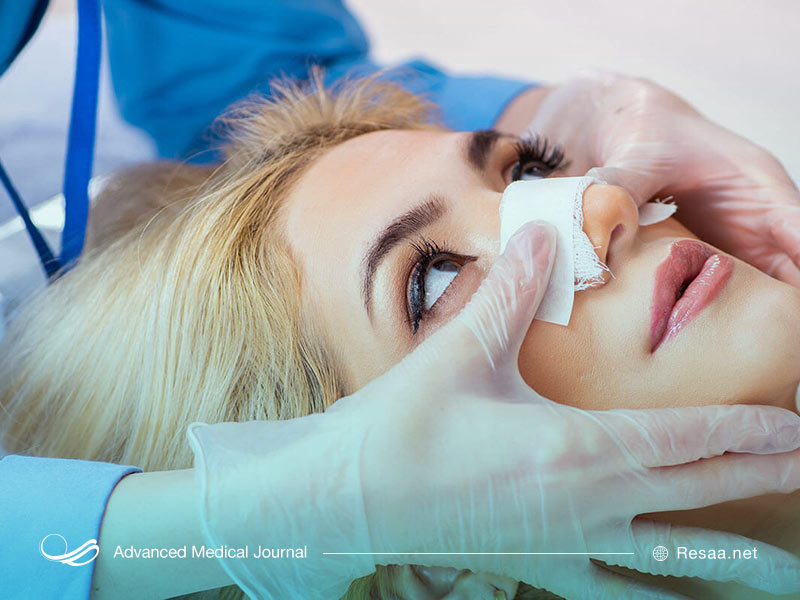 عوارض عمل جراحی بینی