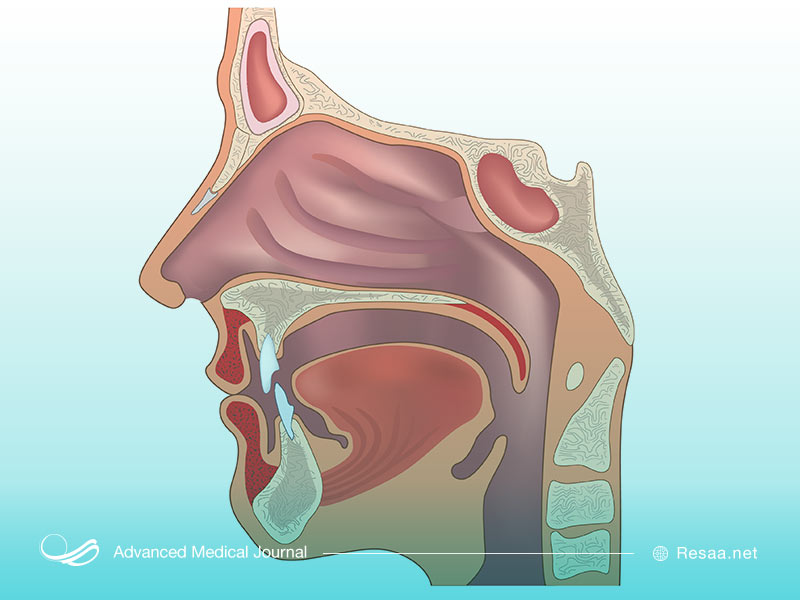 مراجعه به پزشک و درمان خروپف