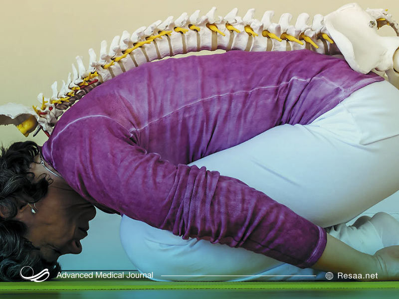 بیماری تورم دیسک