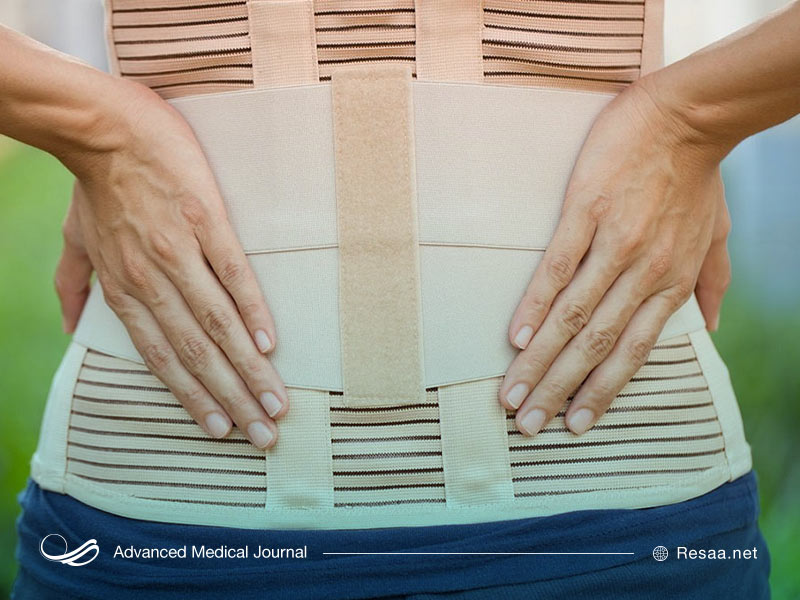 گرفتگی عصب سیاتیک