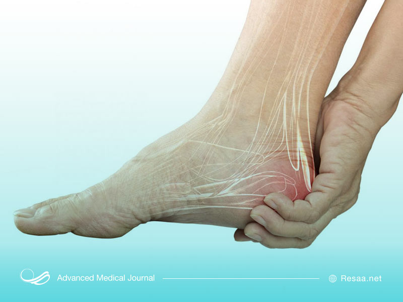 بیماری تنگی نخاع چیست