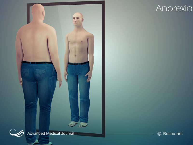بی اشتهایی عصبی چیست