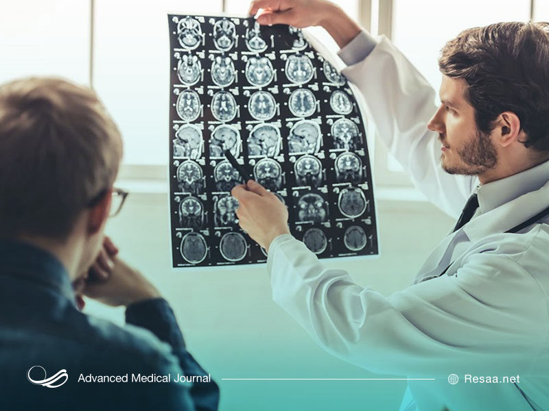 درمان و پیشگیری از اتروفی مغزی