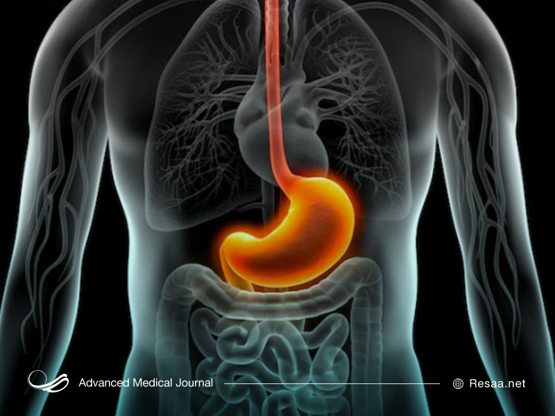 مشکلات گوارشی در ماه رمضان