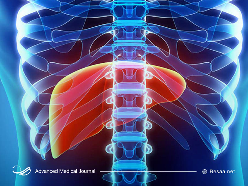 پیوند کبد چیست