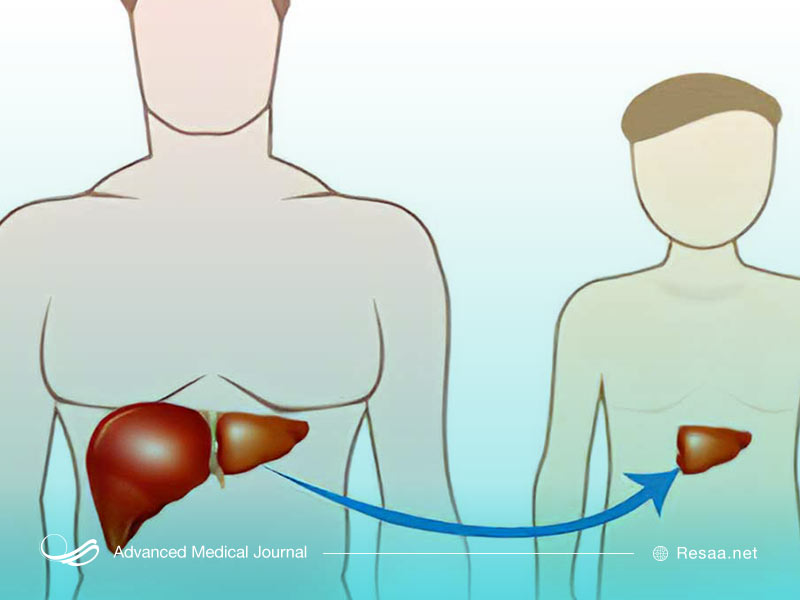 آزمایشهای ضروری برای پیوند کبد