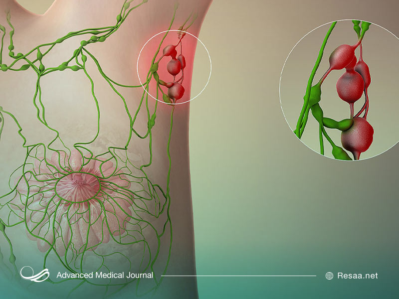 چرا غدد لنفاوی متورم میشوند؟