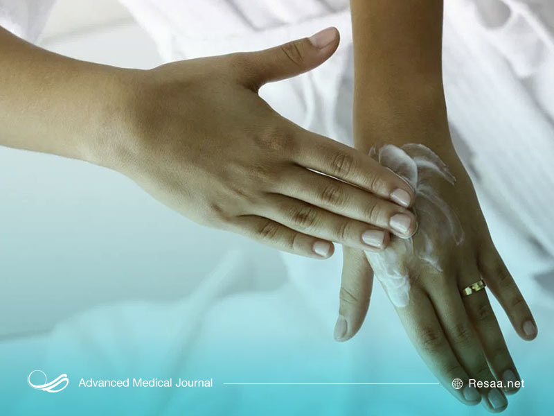 اگزما و پوست پوست شدن بدن راه درمان دارد و بهتر است در صورت پوسته دادن کف دست، پوست را مرطوب نگه دارید.