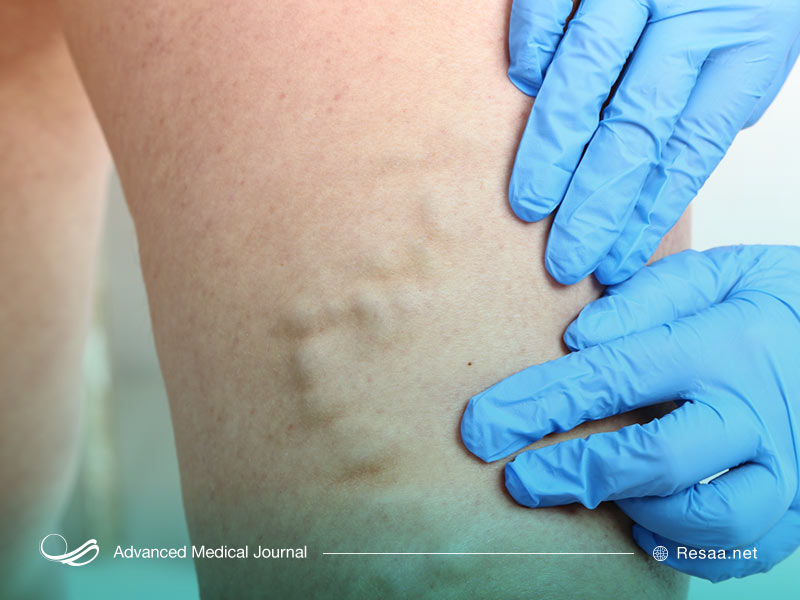 تشخیص بیماری