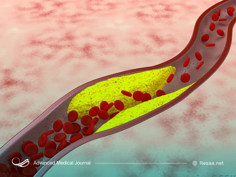 بیماری قلبی