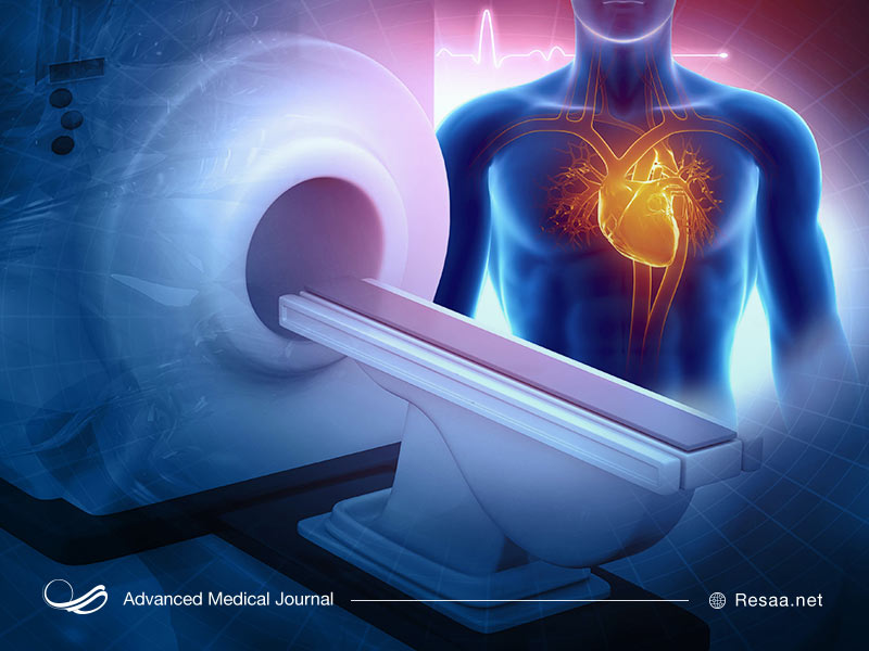 هزینه آنژیوگرافی