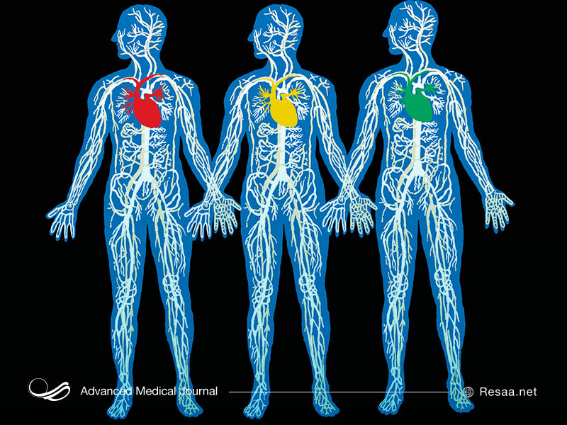 آنژیوگرافی