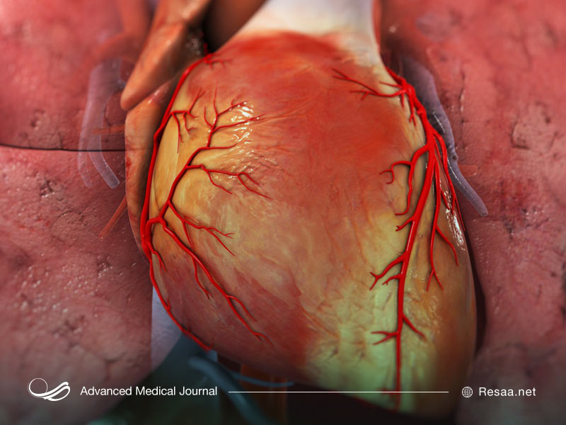 شرایط آنژیوگرافی