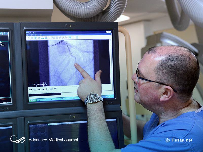 تفسیر آنژیوگرام