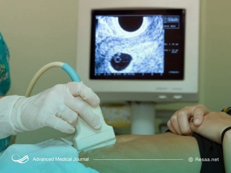 سونوگرافی
