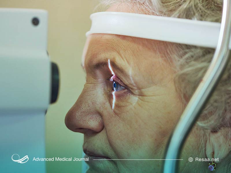 درمان گلوکوم