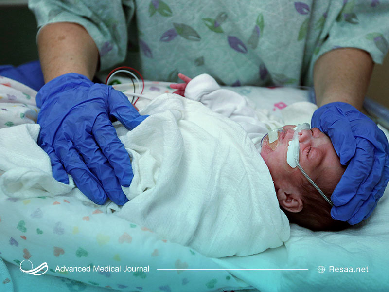 زایمان زودرس