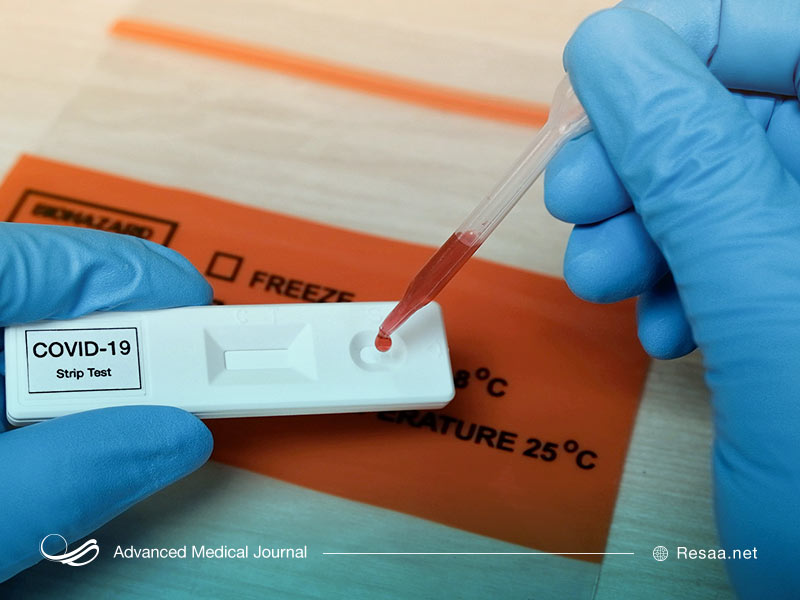 یکی از روشهای تشخیص کرونا تست سرولوژی است