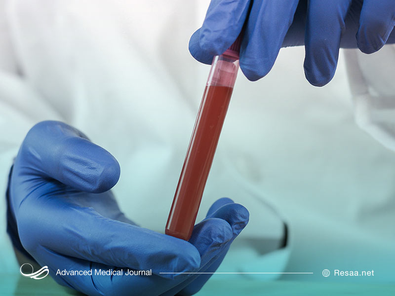 شناسایی ویروس کووید 19