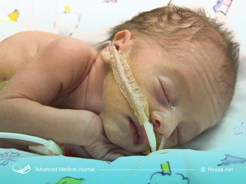 اگر نوزاد شما شیر خشک مصرف می‌کند باید از اینکه شیر خشک حاوی تیامین است اطمینان حاصل کنید.