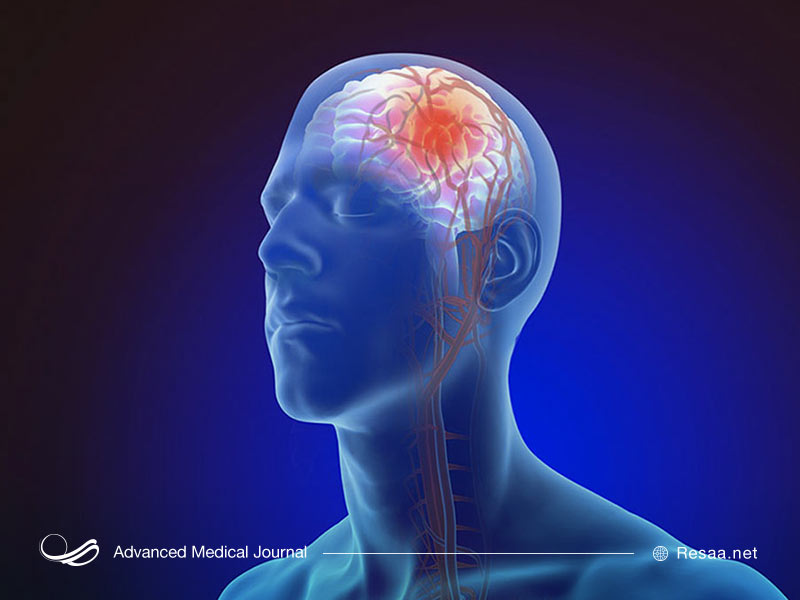 مردن سلول‌های مفزی