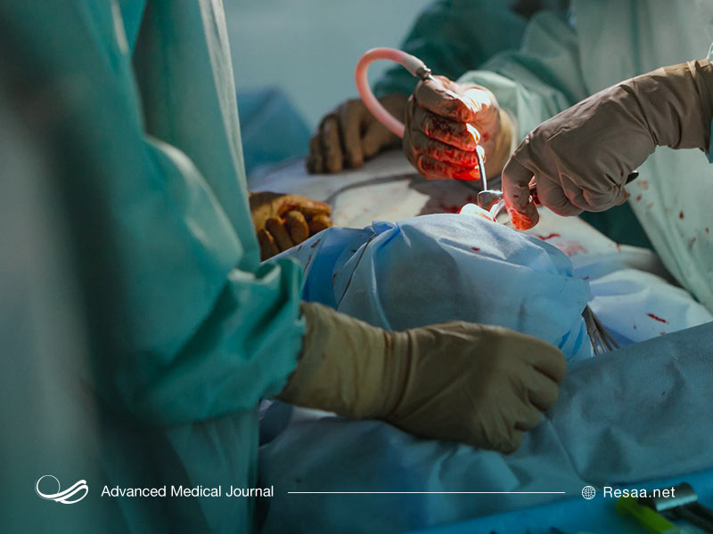 اثرات بعد از عمل