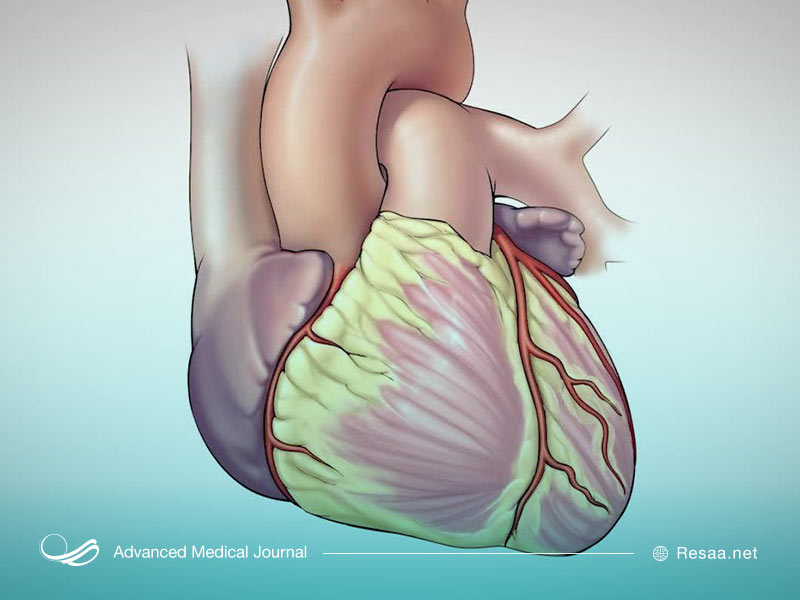 آنژیوپلاستی