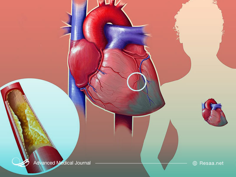 انواع مختلف کلسترول را بشناسیم