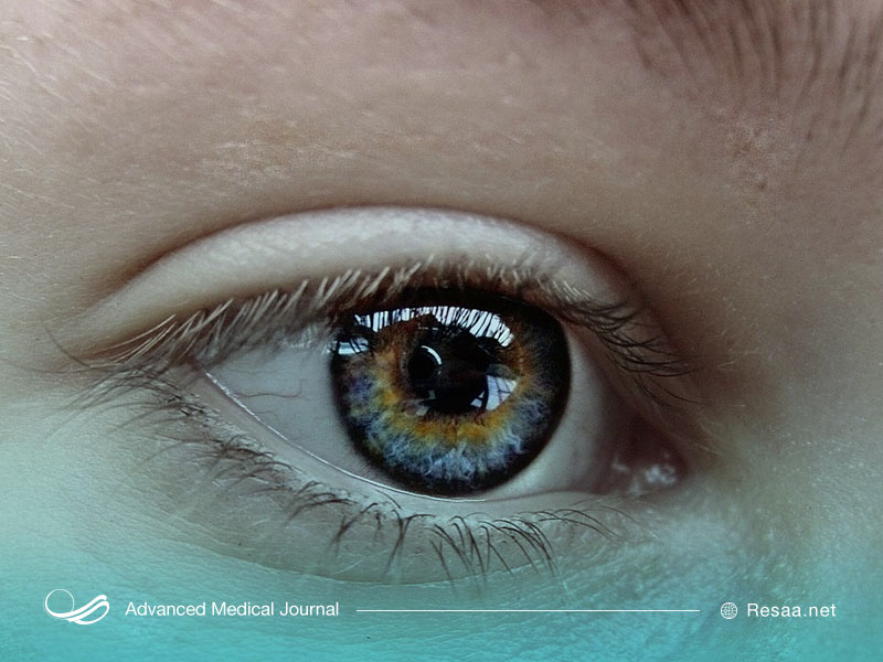 کوررنگی چیست؟