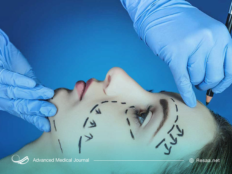 انواع عمل‌های زیبایی صورت