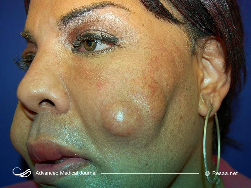 مزایای زیبایی